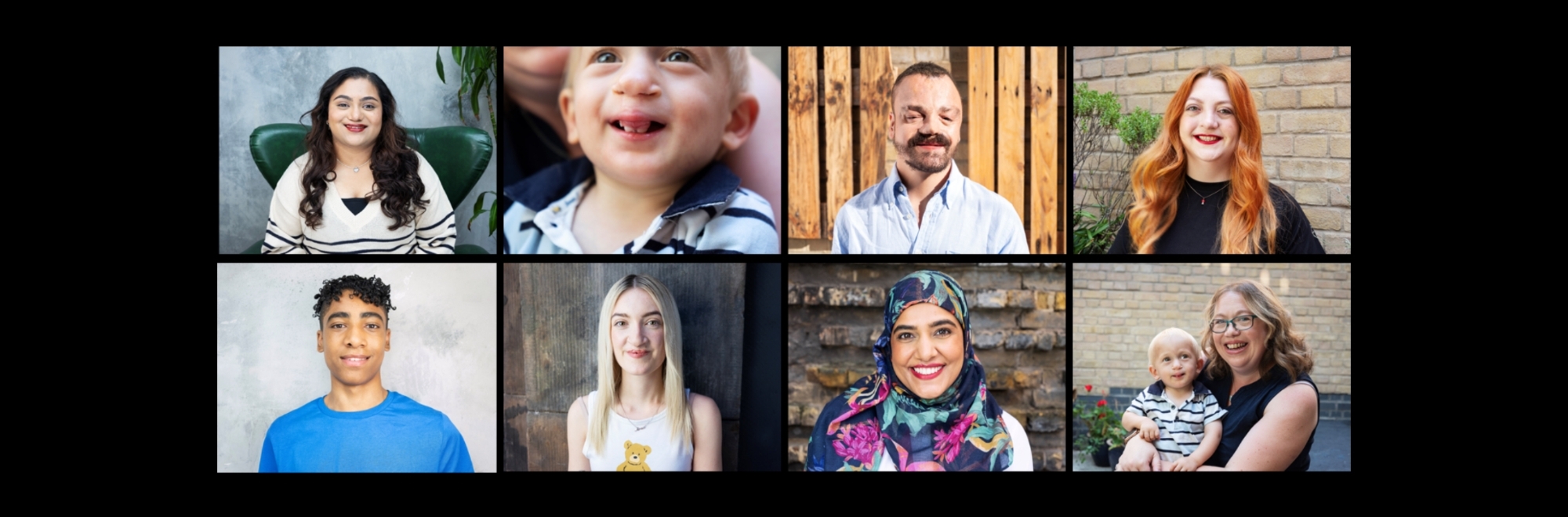 Celebrating 'Beauty In Every Smile' as people affected by facial differences share their experiences